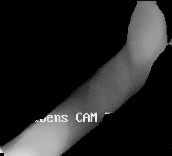 Crop