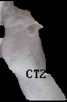 Crop